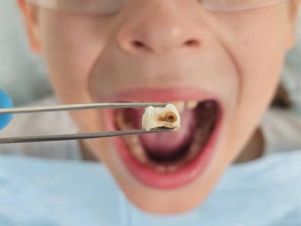 Best Emergency TMJ Treatment in Kimball, TN