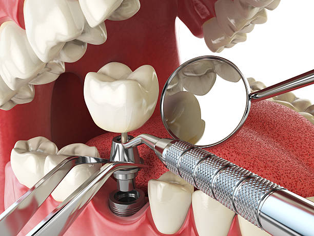 Best Pediatric Emergency Dentist in Kimball, TN